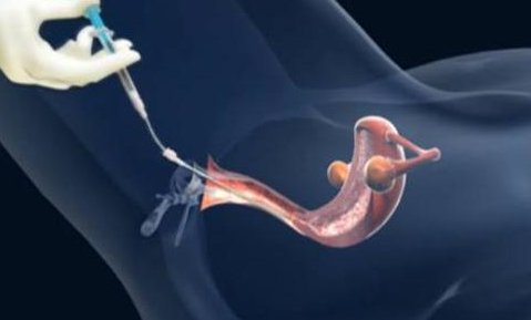 2026年厦门妇幼医院做试管婴儿怎么样？一次试管费用详解！