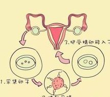 江西地区有哪些私立的机构可以做试管技术？多发性子宫内膜肌瘤做试管能移植囊胚吗？